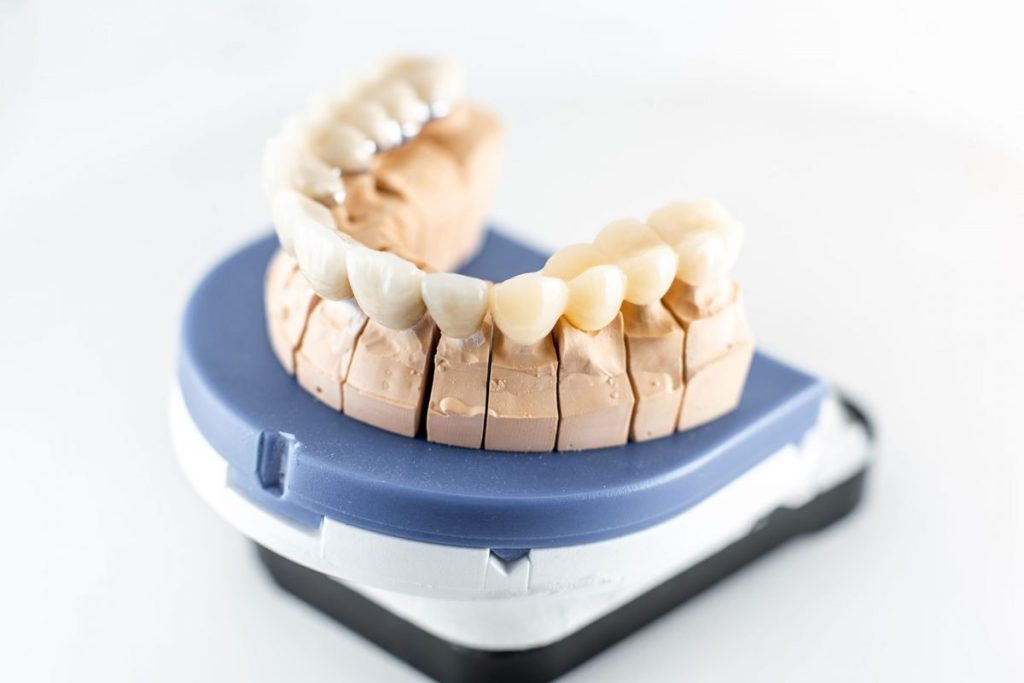 Turkey Dental Implants