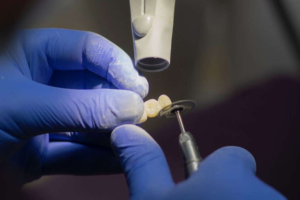 Dental Implants in Turkey