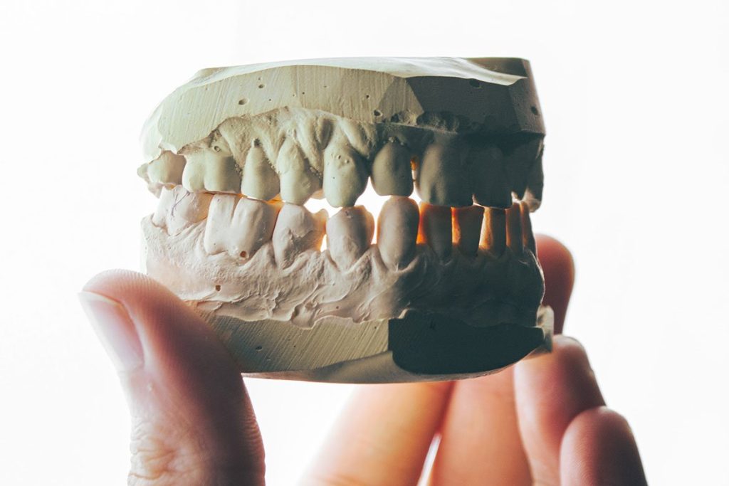 All on 4 Dental Implants