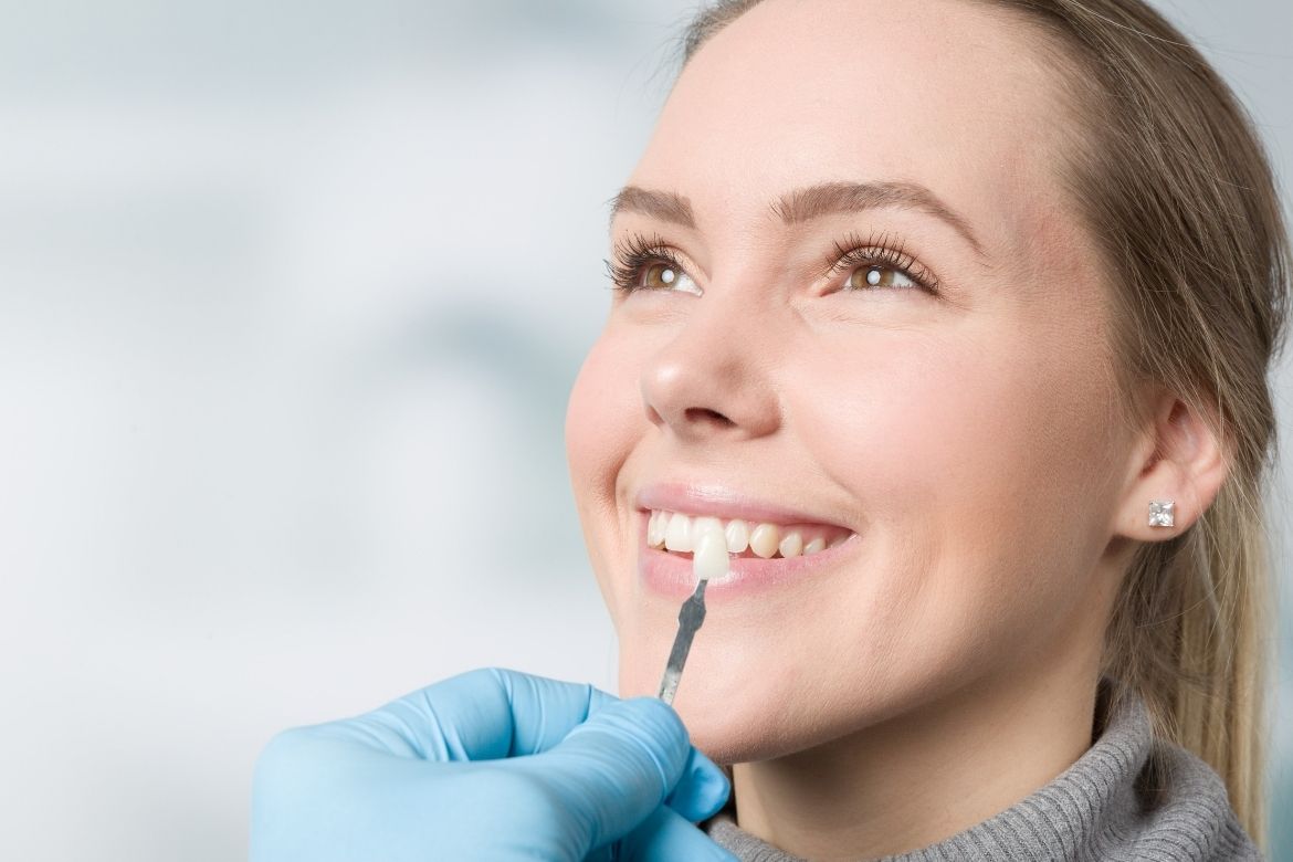 Veneer Teeth Cost Dental Park