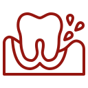 Periodontoloji (Diş Eti Hastalıkları)