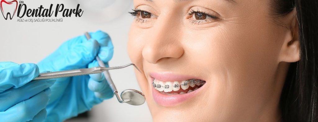 2026 diş teli fiyatları karsılastırma ve çeşitleri