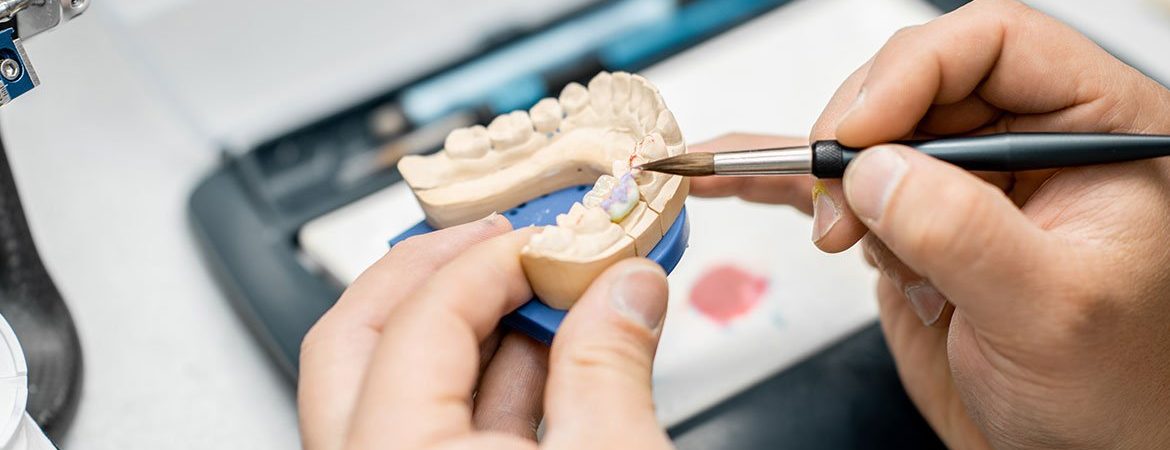 Teeth Implants Turkey